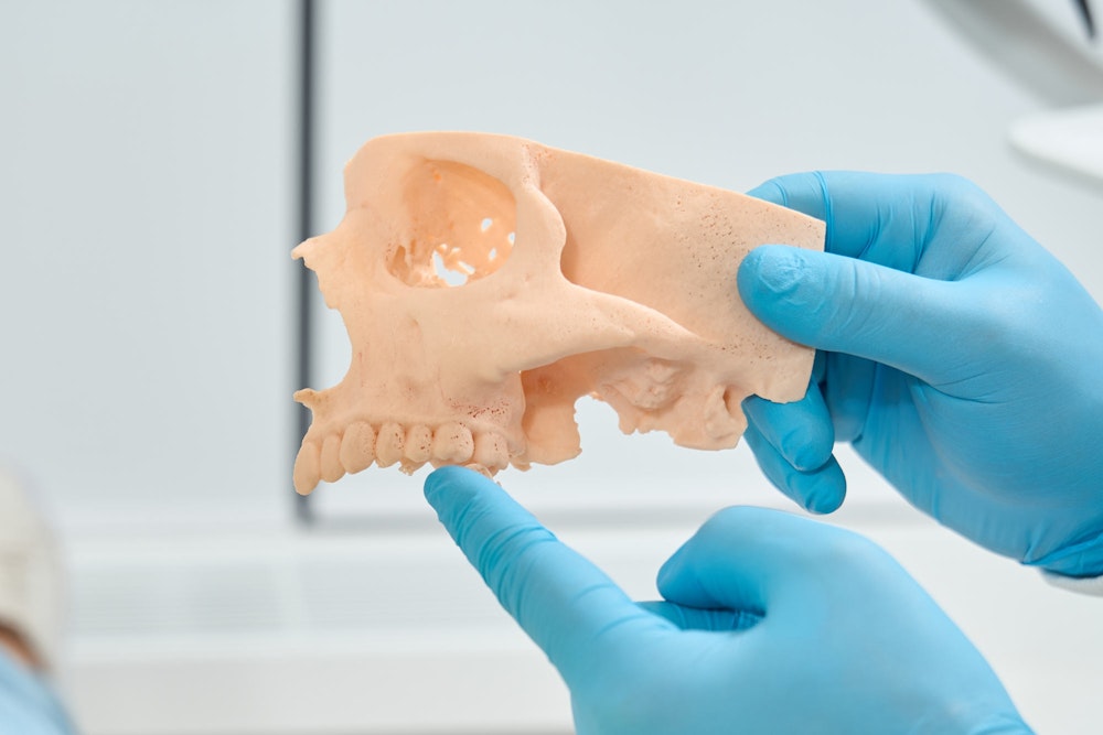 Dentist pointing to model skull to talk about sinus lifts