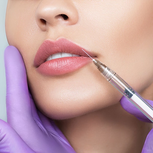 woman getting juvederm
