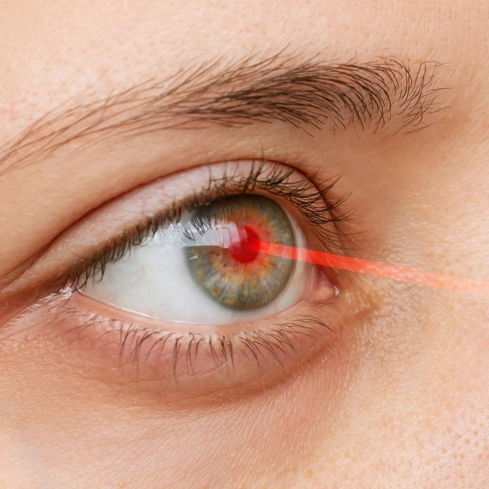 Eye laser surgery