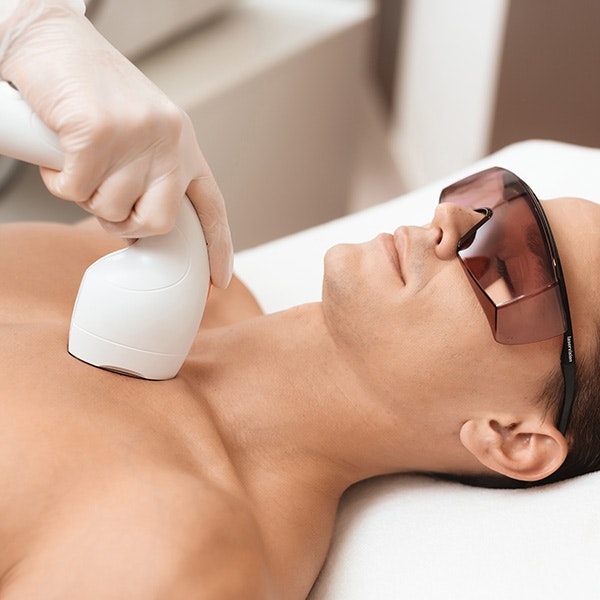 Man getting laser hair removal