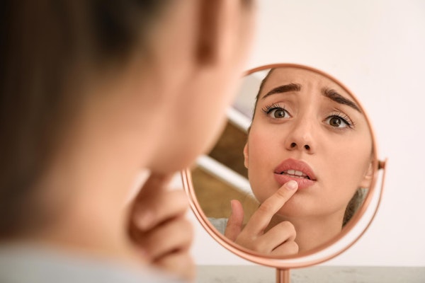 Worried woman looking at cold sore on lip in the mirror