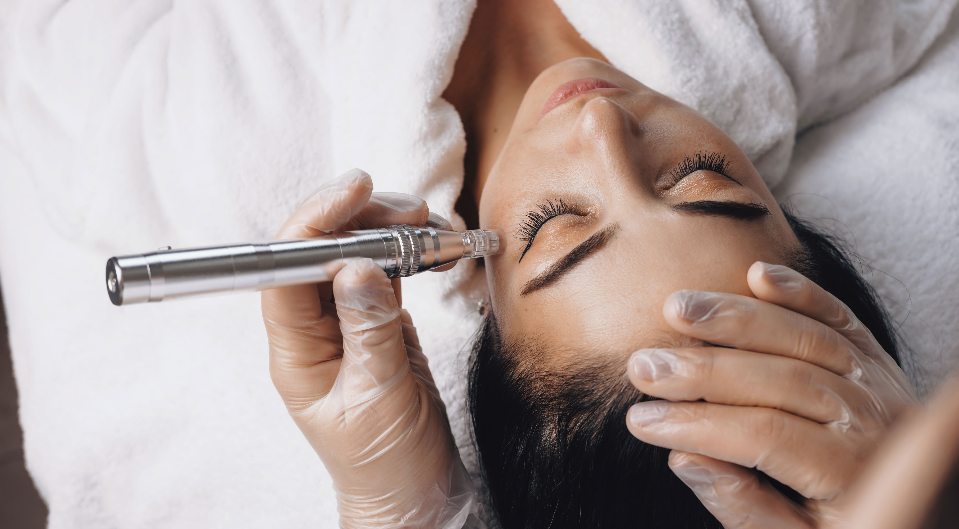 Microdermabrasion