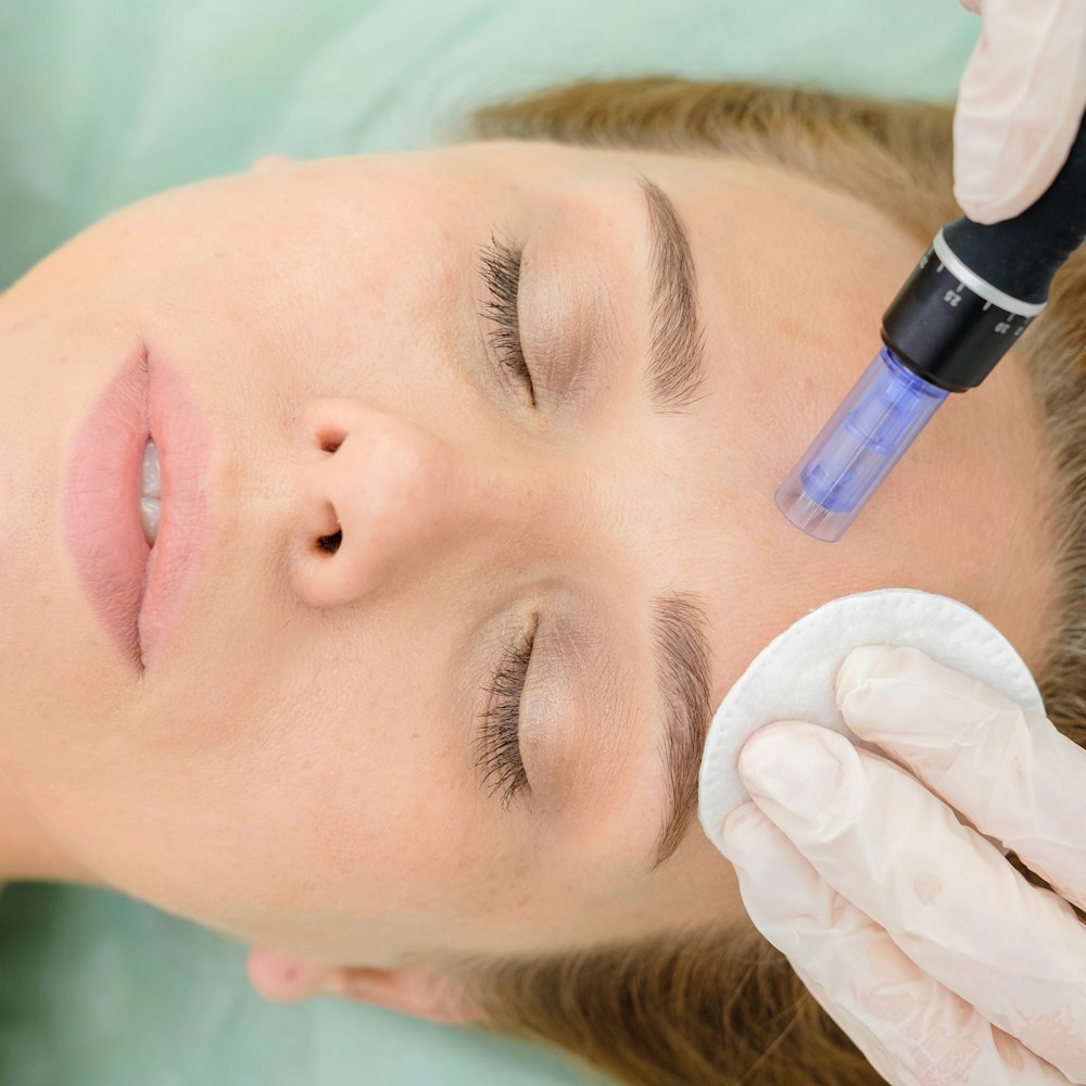 Microneedling procedure