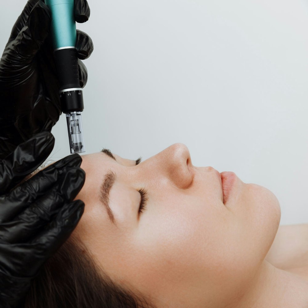 Woman receiving microneedling