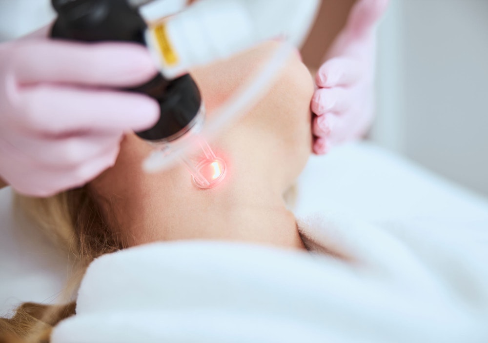 Woman undergoing laser neck lift