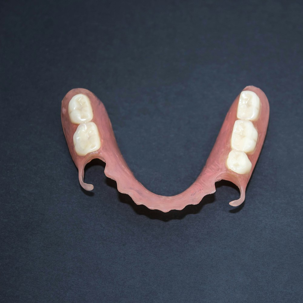 Съемный зуб бабочка. Нейлоновый микропротез 1-3 зуба. Протез нейлоновый односторонний (Flexi n512). Микропротез бабочка на 3 зуба. Частичный съемный пластиночный протез на 1 зуб.