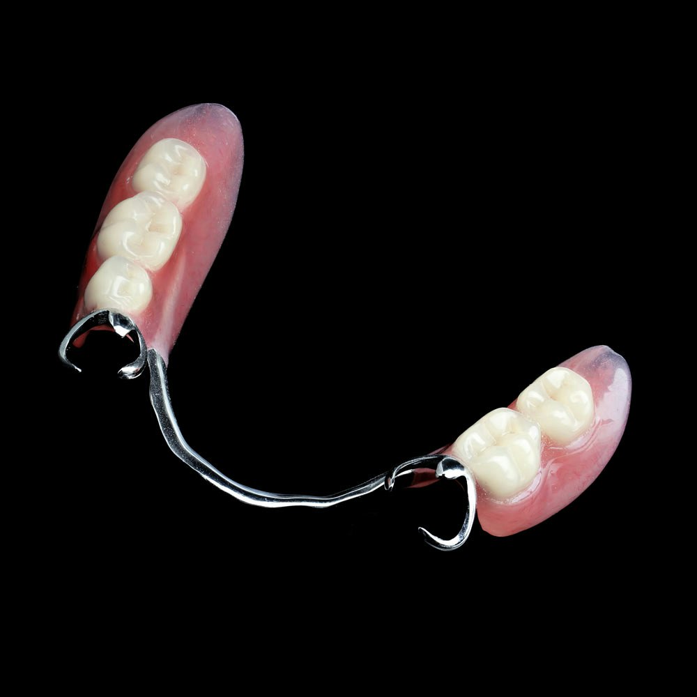 Partial Denture