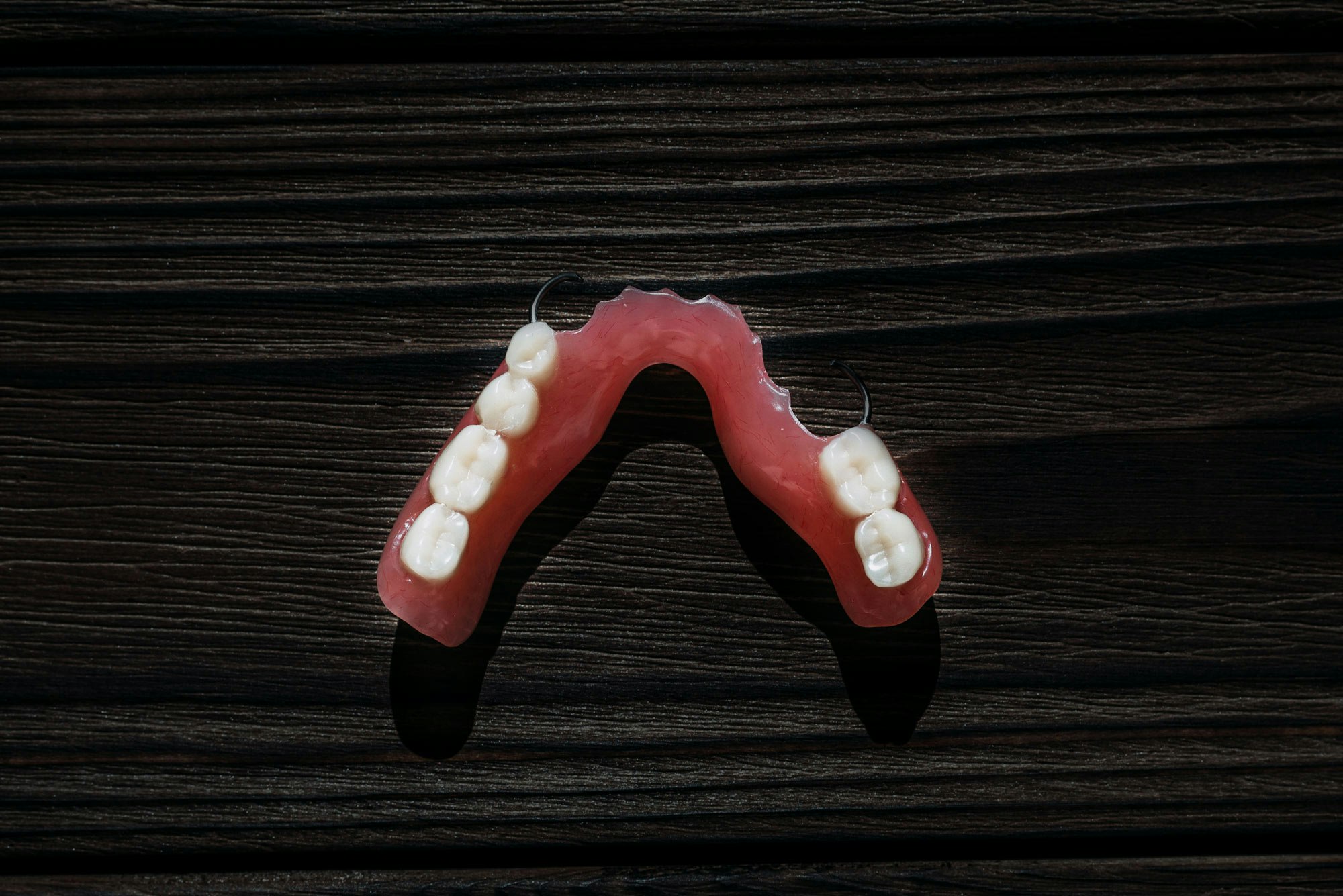 Partial Denture