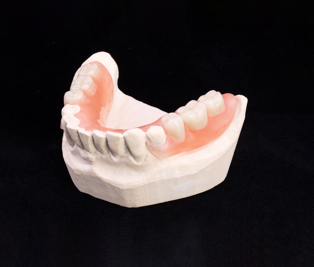 Partial denture