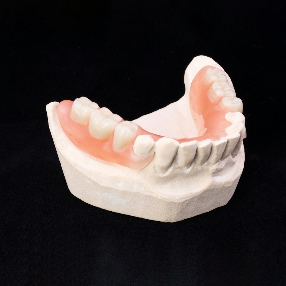 Partial Denture