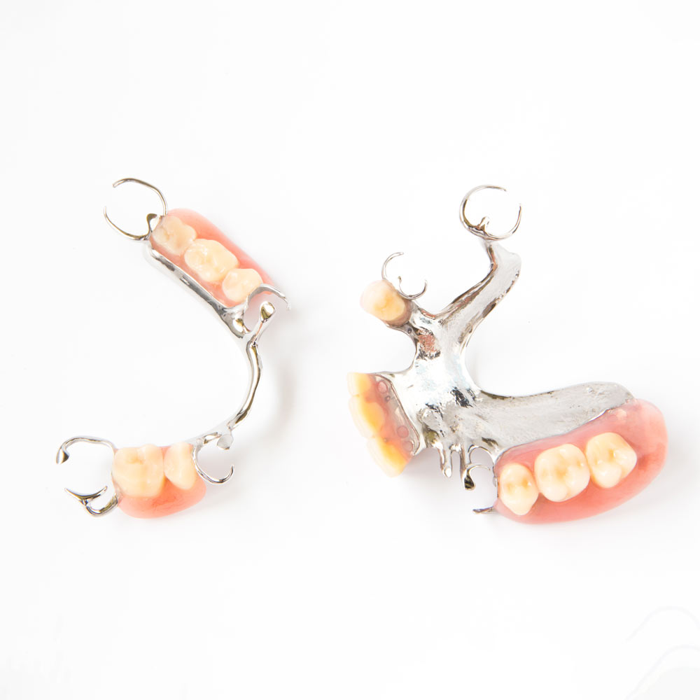 Partial dentures