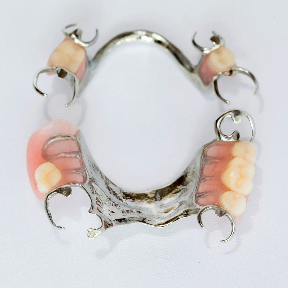 a set of partial dentures