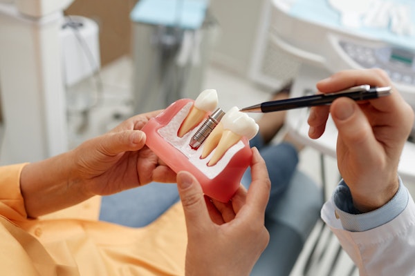 Implant Restorations