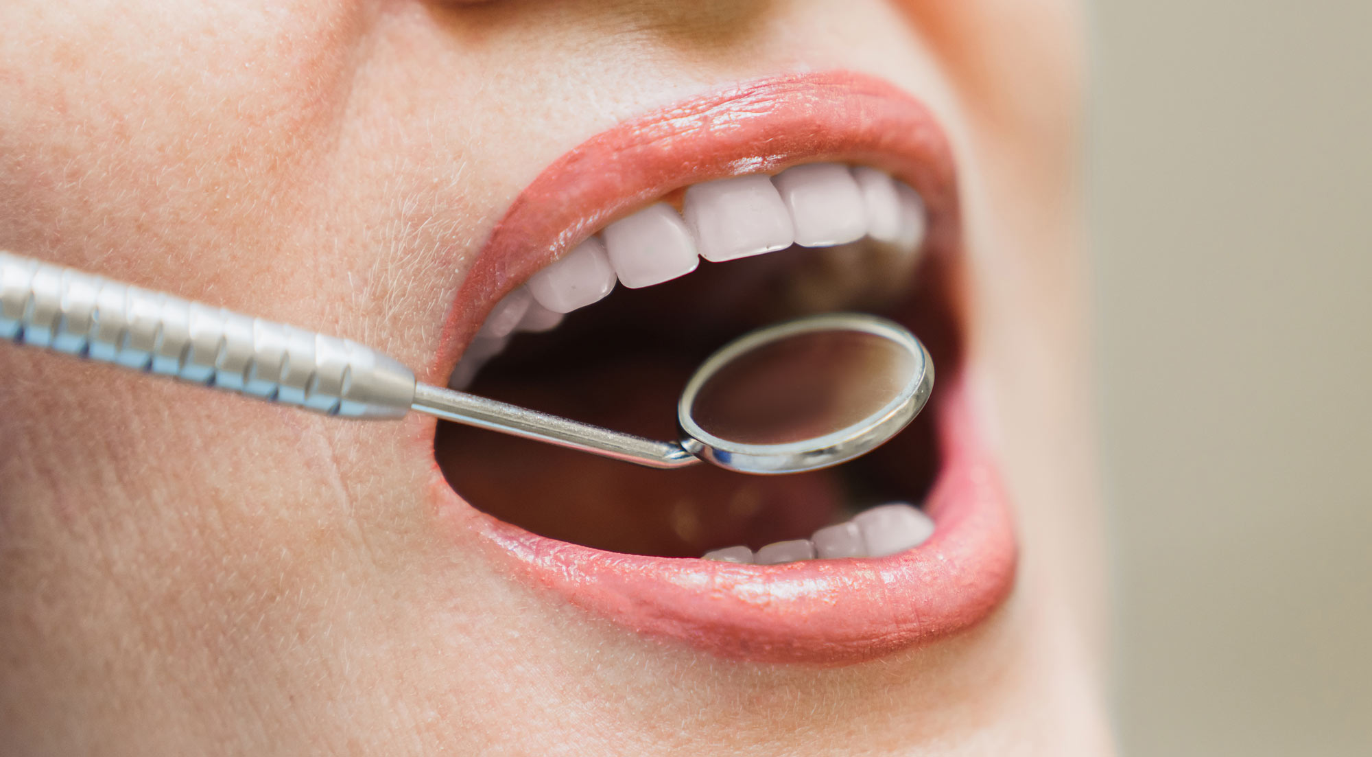 Close up of patient smiling at the dentist