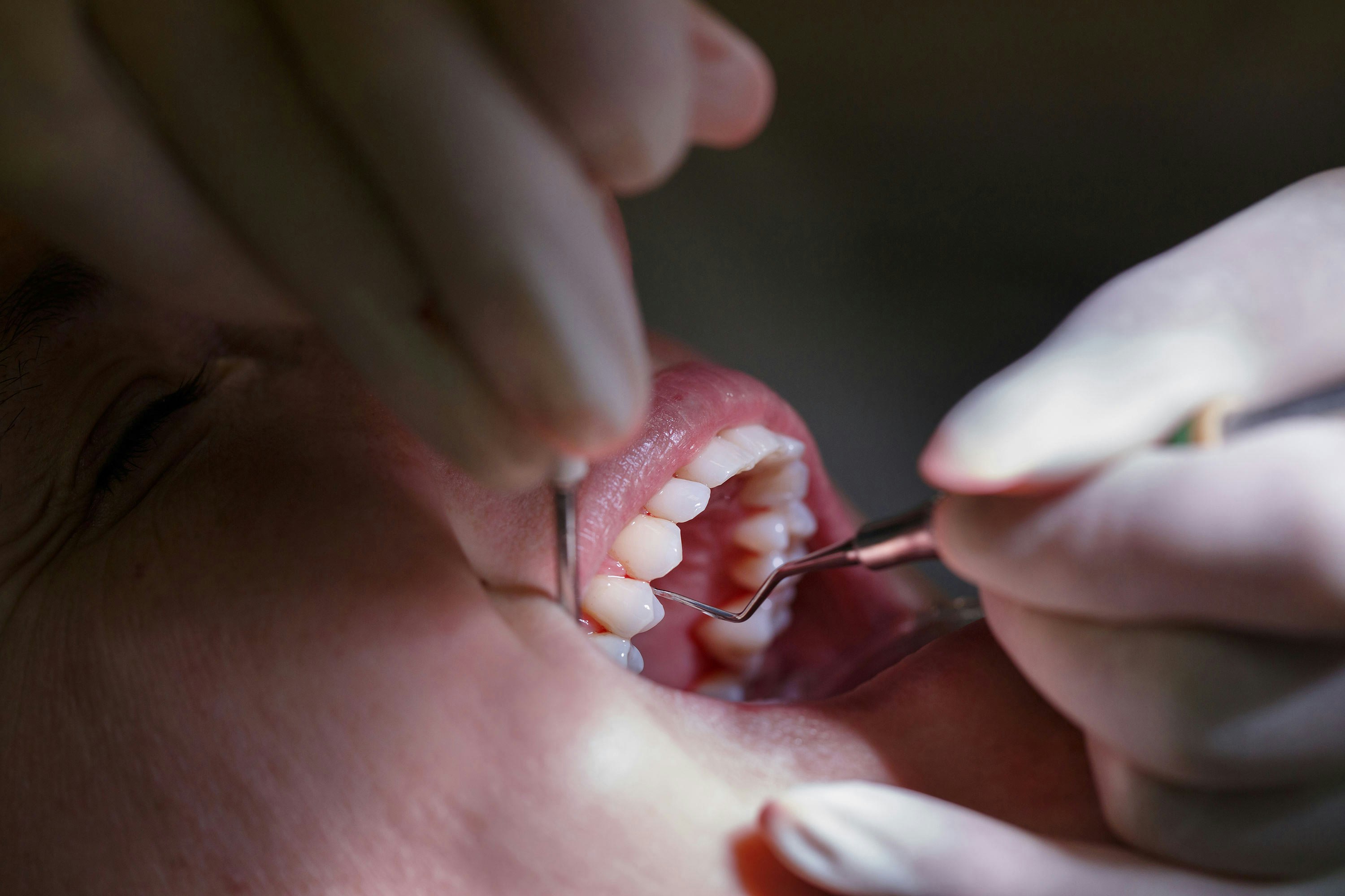 Woman in need of periodontics