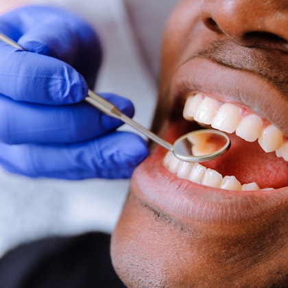 Man smiling during a routine cleaning visit