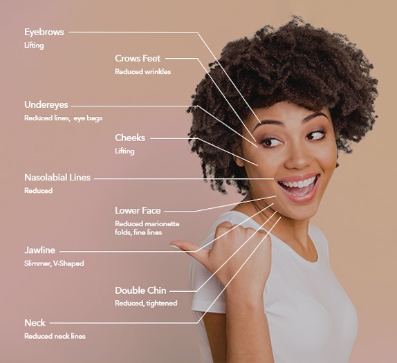 Smiling woman with diagram of the areas that FaceTite can target