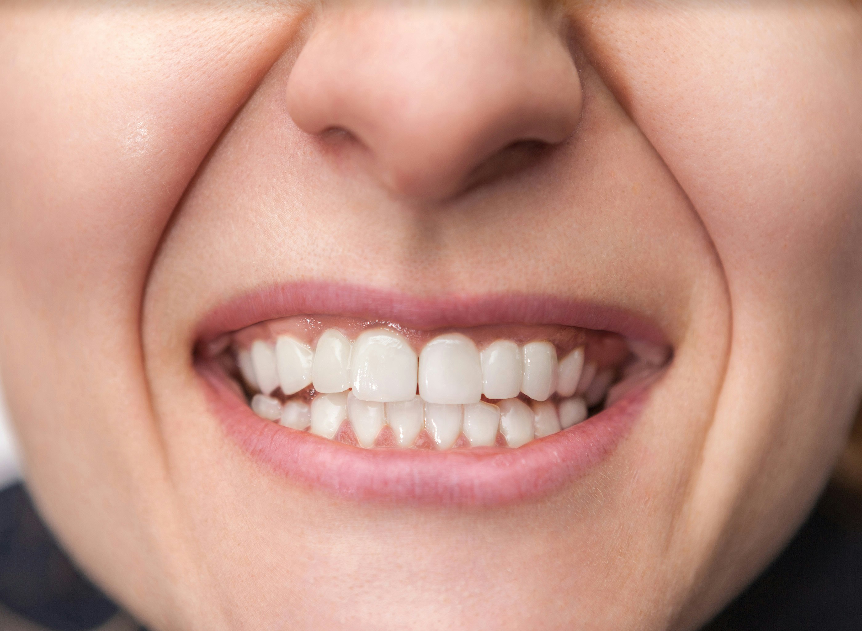 After restorative dentistry