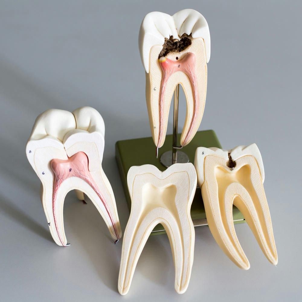 Root canal models