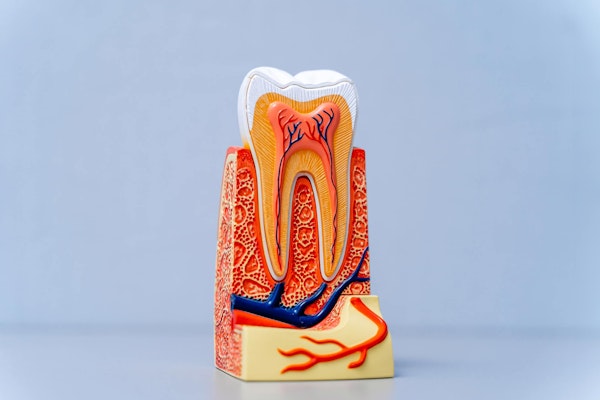 Root canal model