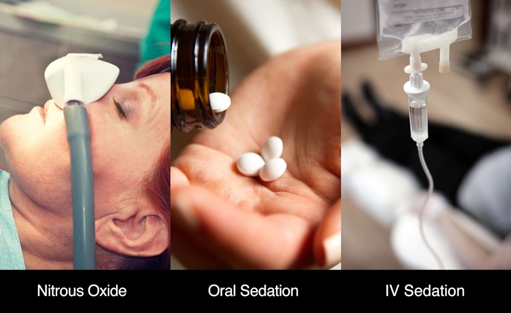 Sedation options