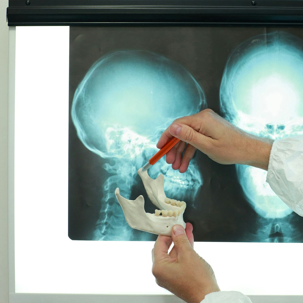 Model and x-ray of the jaw