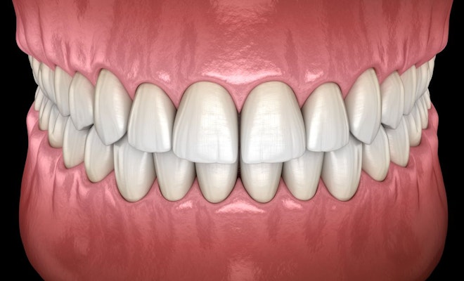 Teeth