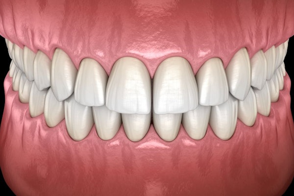 Illustration of straight, white teeth