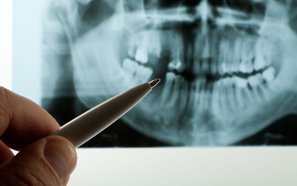 Dentist pointing at a x-ray of root canal 