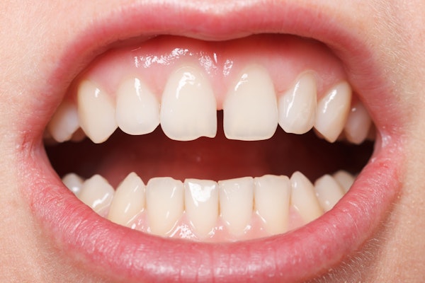 A person's upper and lower teeth