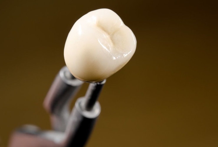 Dental Crown Close-up