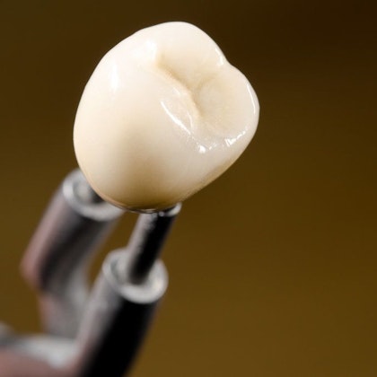 image of dental implant crown with tweezers