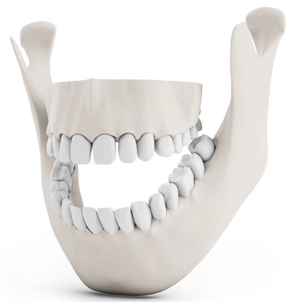 illustration of ridge augmentation
