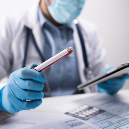 Lab technician looking at blood tests