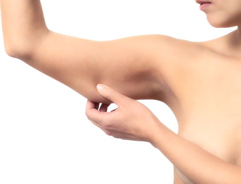 Woman pinching her arm