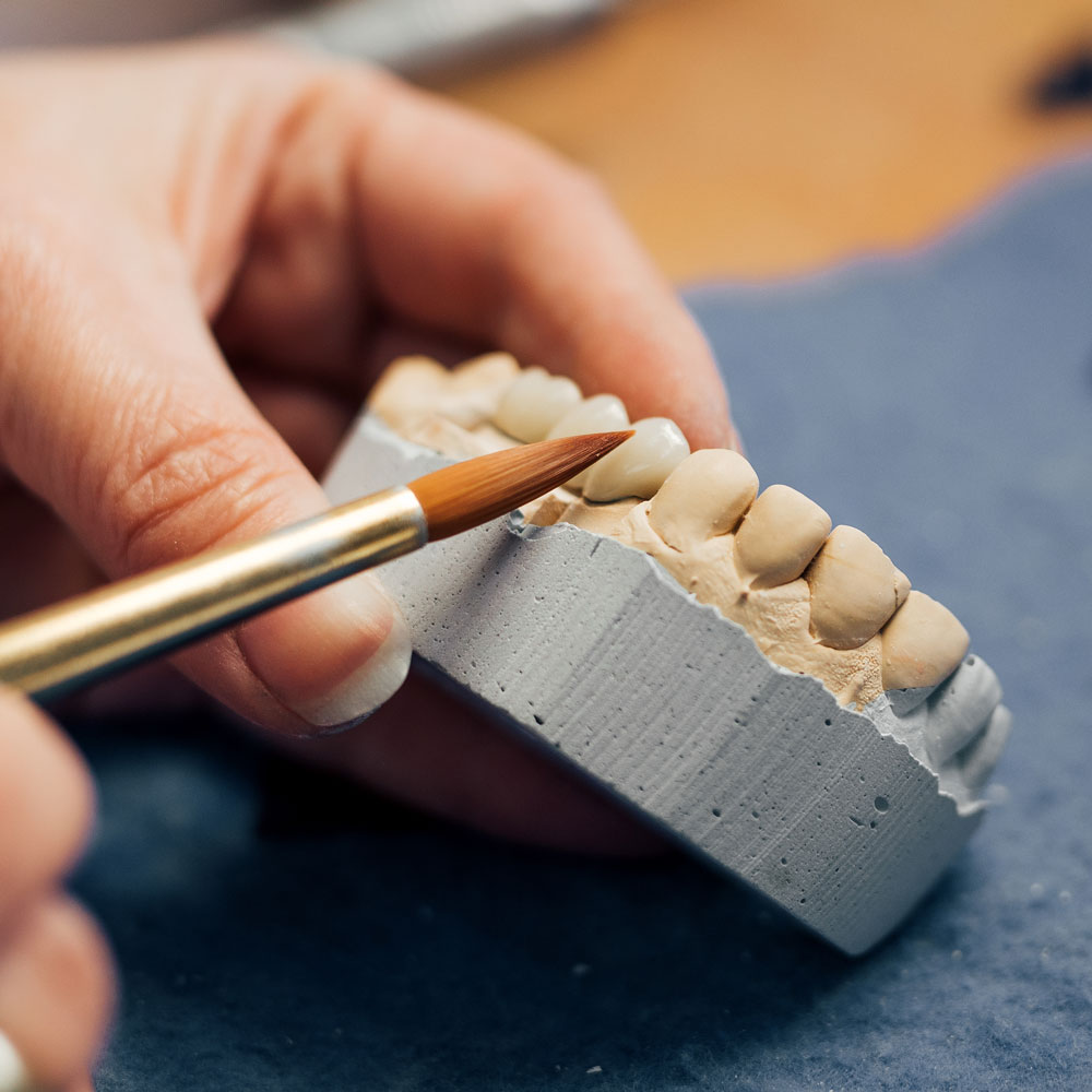 crafting a dental bridge