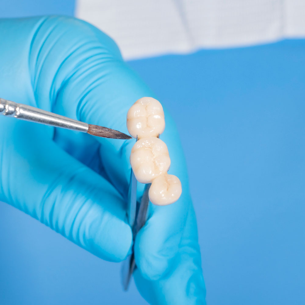 ceramist crafting dental bridge