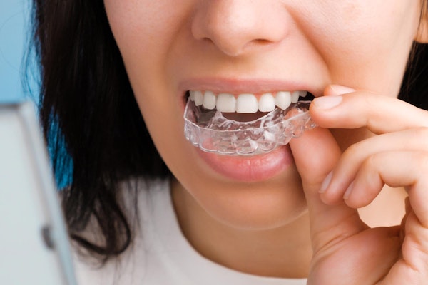 Cordova woman putting in ClearCorrect aligner