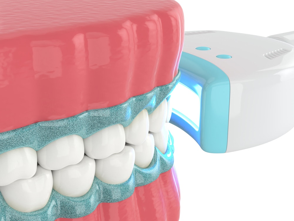 illustration of yellowed teeth