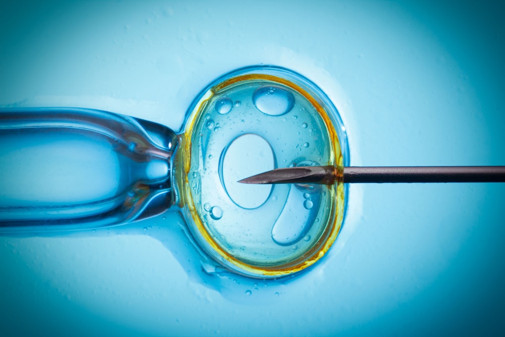 IVF process under microscope