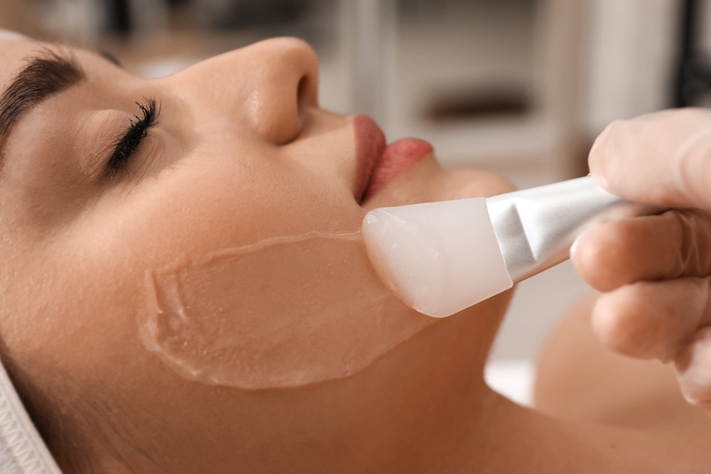 Woman getting a chemical peel