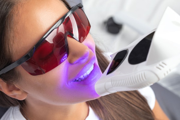 Woman getting teeth whitened