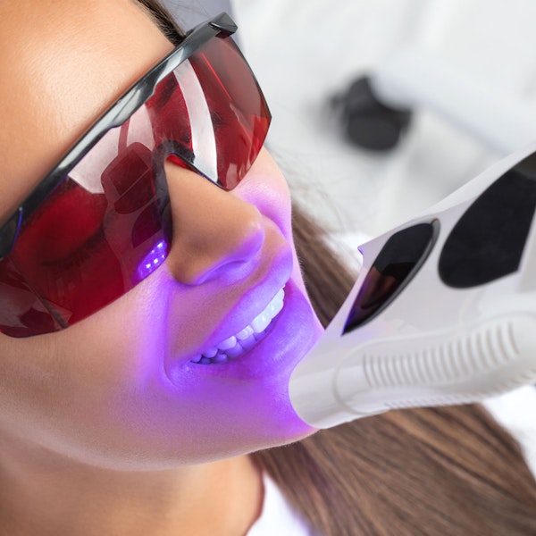Woman getting teeth whitened