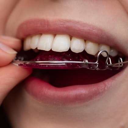 Woman putting on retainer
