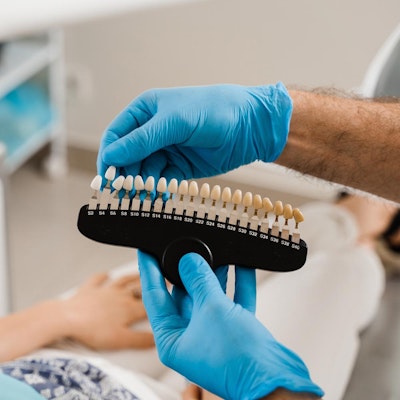 dentist holding model of veneer shades