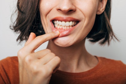 Woman looking at her gums