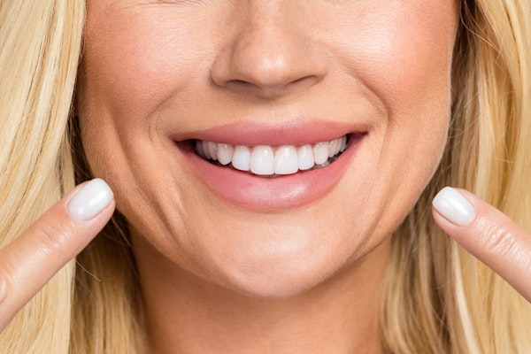 woman pointing at her Teeth Whitening