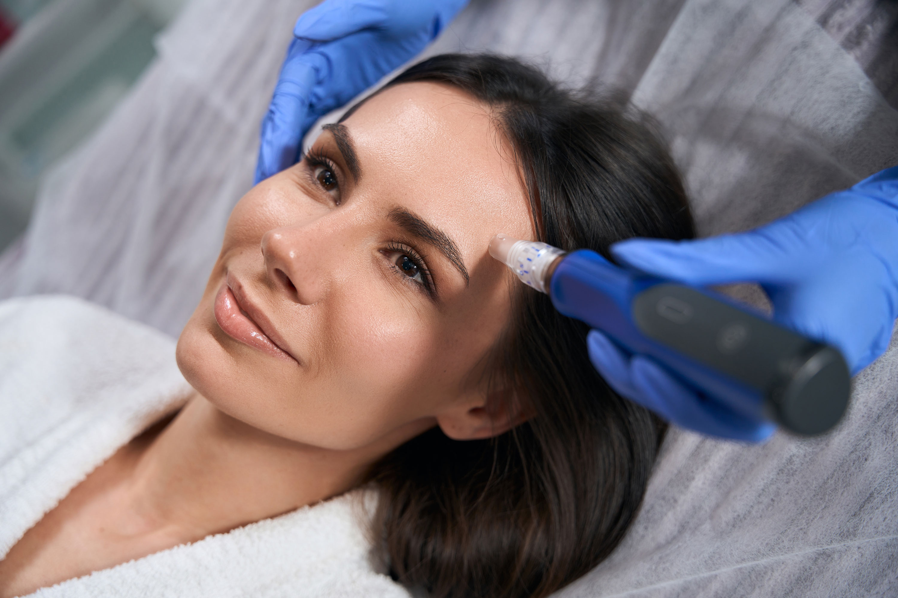 Woman at a microneedling appointment