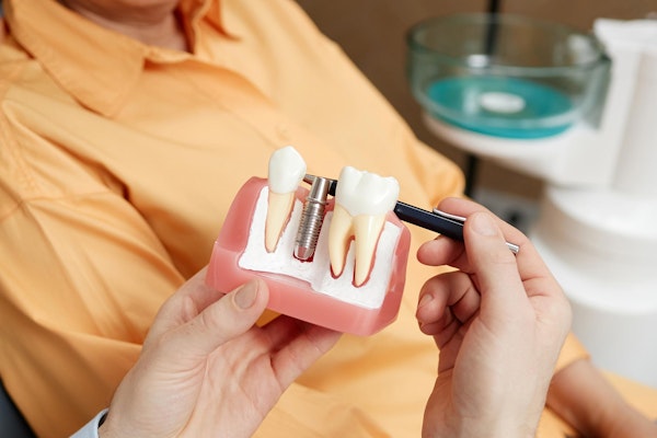 dental implant model