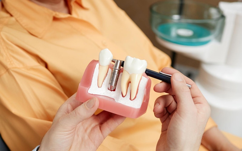 model of a dental implant-supported crown in the jaw